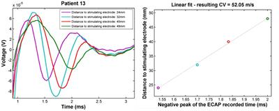 Postsynaptic dorsal column pathway activation during spinal cord stimulation in patients with chronic pain
